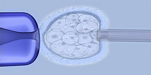 Ms stem cell treatment news