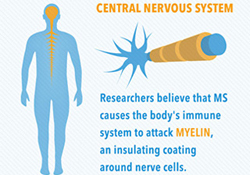 nervous system multiple sclerosis