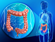 Colorectal cancer could be stopped